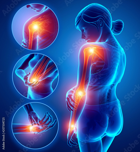 3d Illustration of Female Feeling Arm joint pain