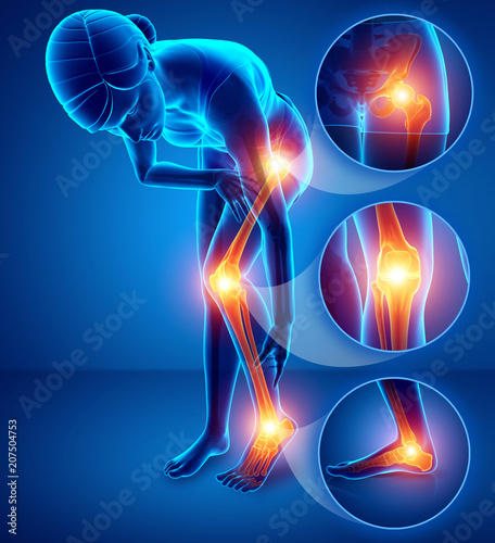 3d Illustration of Female feeling Leg pain