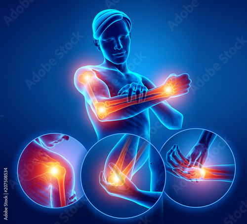 3d Illustration of Men Feeling Arm joint pain photo