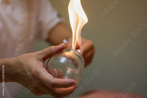 Woman preparing glass cup with flame for cupping therapy for pain relief photo