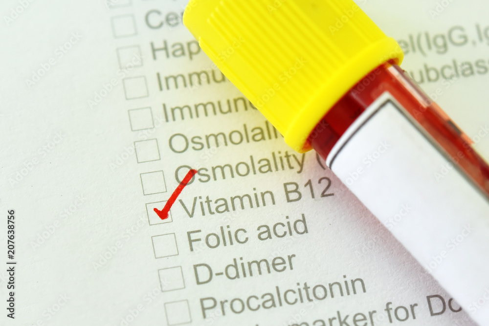 Lab Tube For Vitamin B12 at Scott Rustin blog