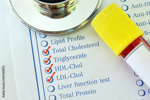 Фотография Laboratory requisition form with blood sample tube for lipid profile test