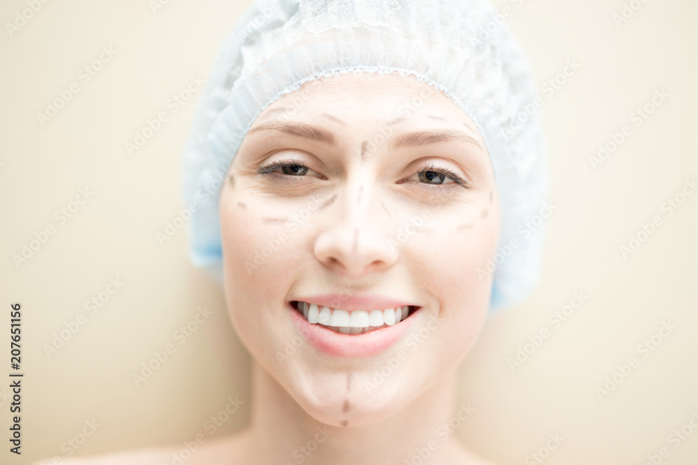 Happy young woman with toothy smile having marks around her eyes, along her nose and chin Happy young woman with toothy smile having marks around her eyes, along her nose and chin