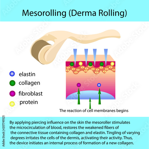 Mesorolling process with a describtion and cell structure