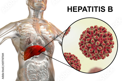 Liver with Hepatitis B infection highlighted inside human body and close-up view of Hepatitis B Viruses, medical concept, 3D illustration photo