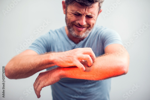 People scratch the itch with hand, Elbow, itching, Healthcare And Medicine, Men with skin problem concept