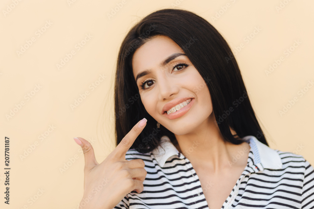 Close up portrait of delighted brunette female with dark eyes, nice make up, indicates at mouth, has broad smile, demonstrates white teeth with braces, shows her beauty, isolated on blank wall Close up portrait of delighted brunette female with dark eyes, nice make up, indicates at mouth, has broad smile, demonstrates white teeth with braces, shows her beauty, isolated on blank wall