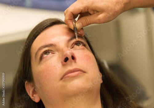 Healthcare concept - Chalazion during eye examination and operation