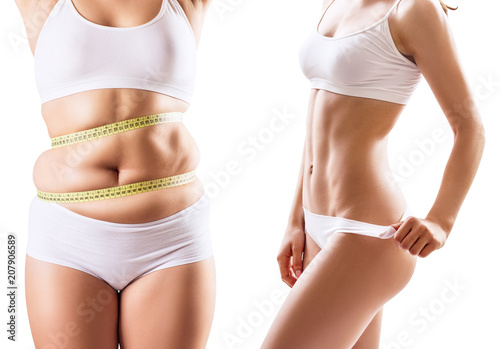 Woman's body before and after weight loss.