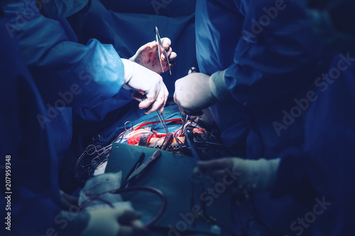 Team of surgeons minimally invasive aortic valve surgery replacement with sutures placed of each commissure suspended. Sutures are placed through the annulus and through the aortic prosthesis and tied photo