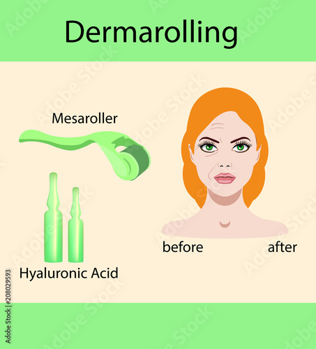 Vector illustration, derma mesorolling and before after effect