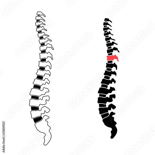 Vector human spine illustration