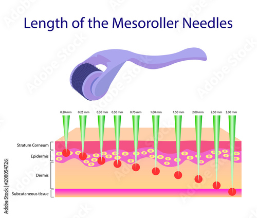 Length of the mesoroller needles, Vector illustration