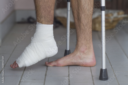Broken ankle