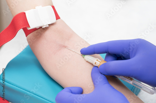 caucasian nurse with blue latex glowes is taking blood for analysis or research from patient vein to plastick vial