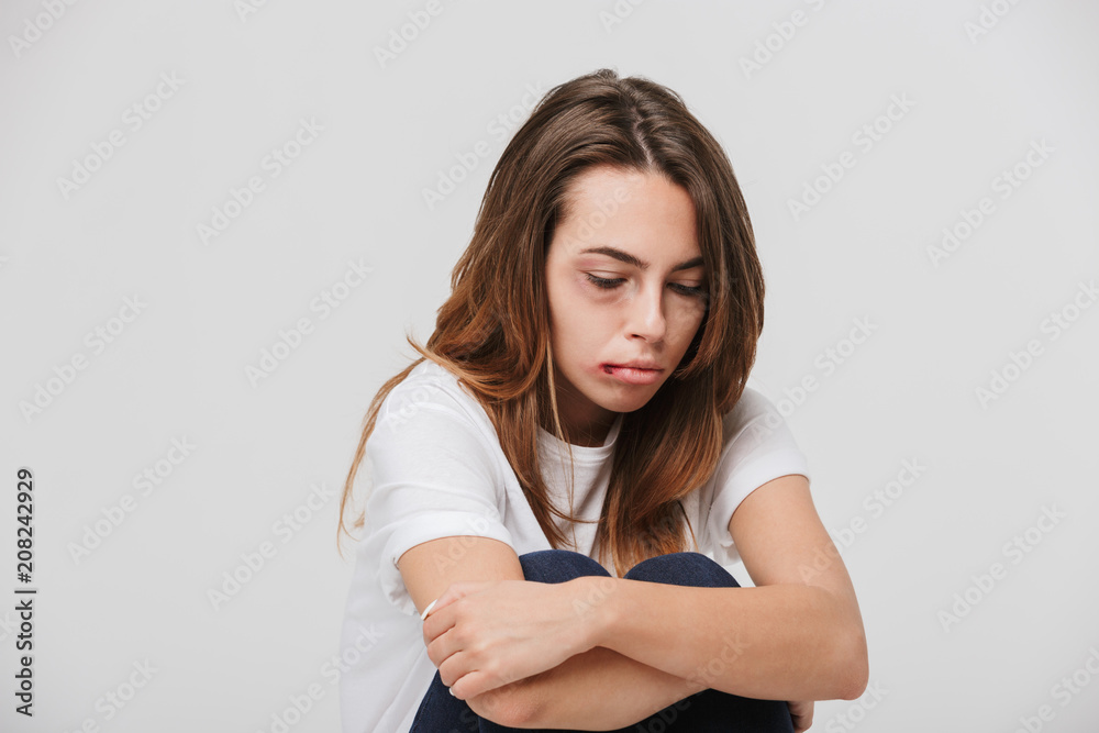 Fototapeta premium Disabled young girl with scratches and bruises on her face.