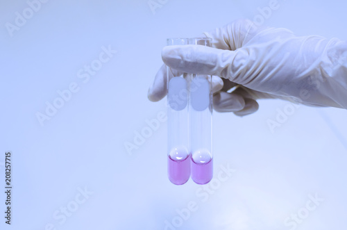 Determination of acetic acid production by titration using phenolphthalein as indicator photo