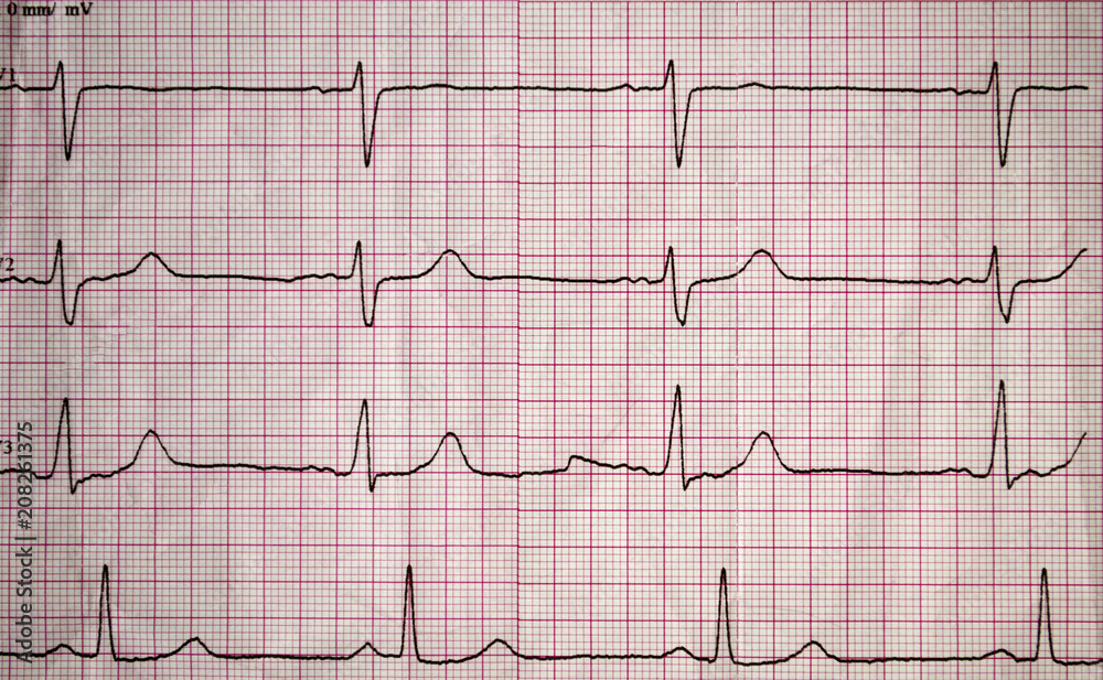 Real tape with the cardiogram of man. Image of Electrocardiogram close-up.