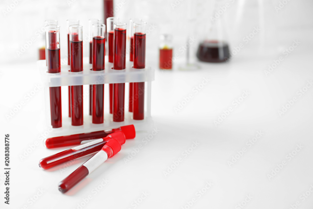 Test tubes with blood samples on table Test tubes with blood samples on table