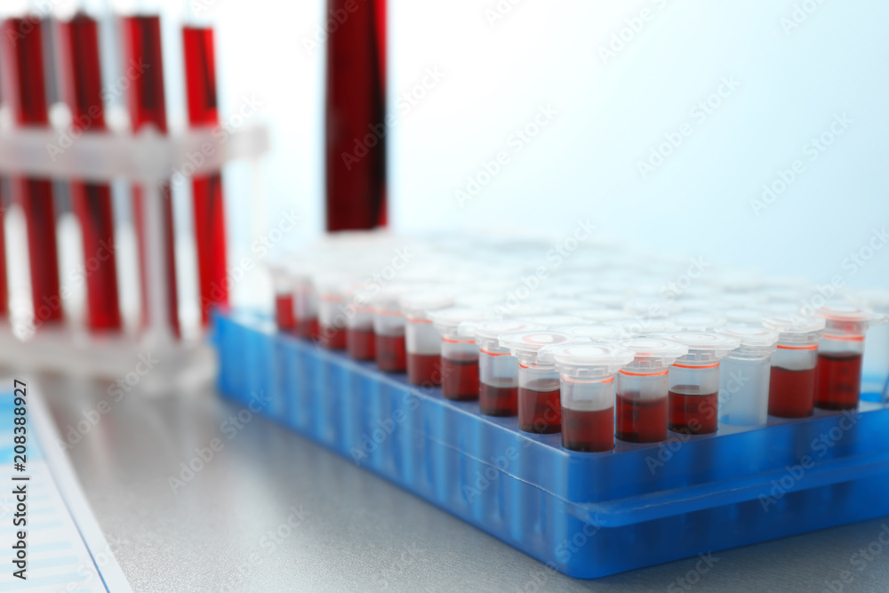 Test tubes with blood samples in holder on table Test tubes with blood samples in holder on table
