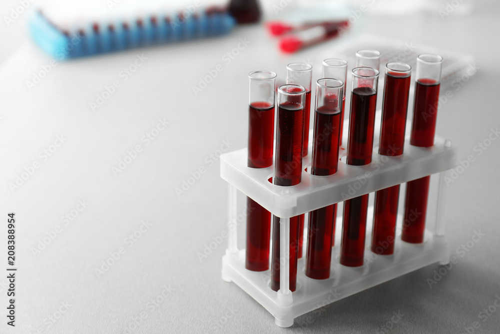 Test tubes with blood samples in holder on table Test tubes with blood samples in holder on table