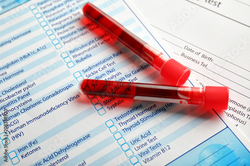 Test tubes with blood samples on forms