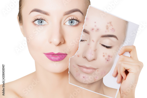 portrait of woman with clean skin holding portrait with pimpled skin