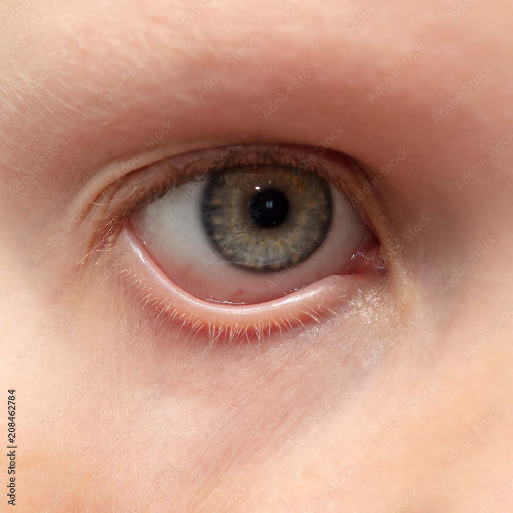 The boy's eyes are like a background The boy's eyes are like a background