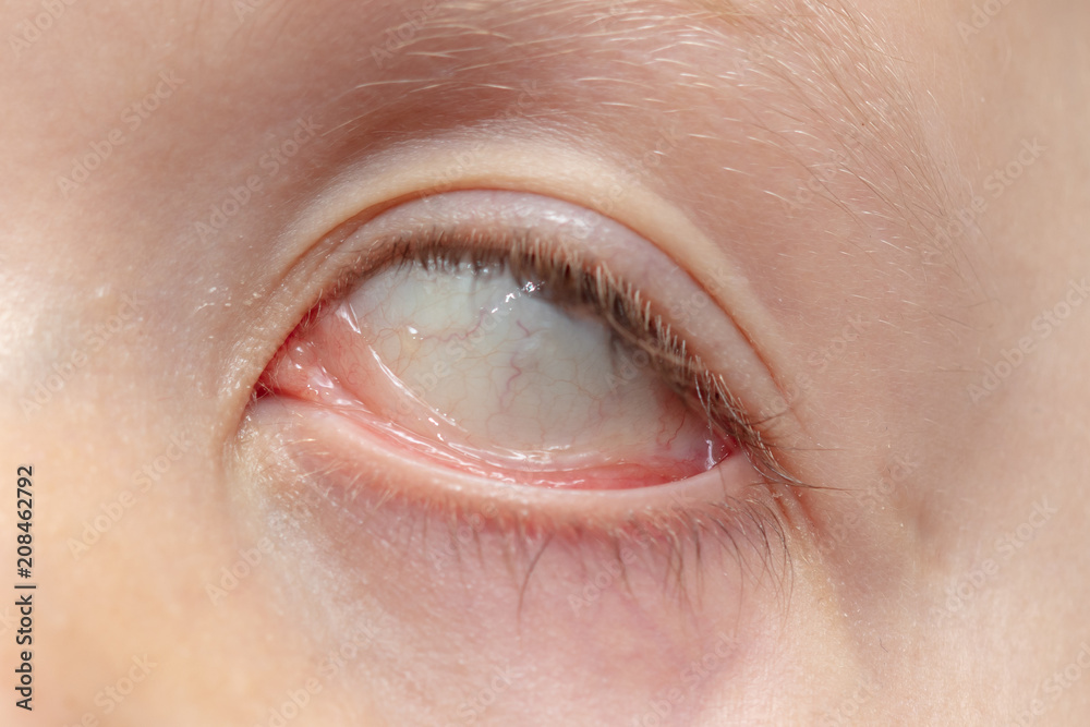 Fototapeta premium The boy's eyes are like a background