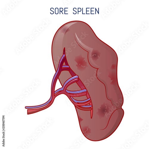 Sore spleen icon. Cartoon of sore spleen vector icon for web design isolated on white background photo