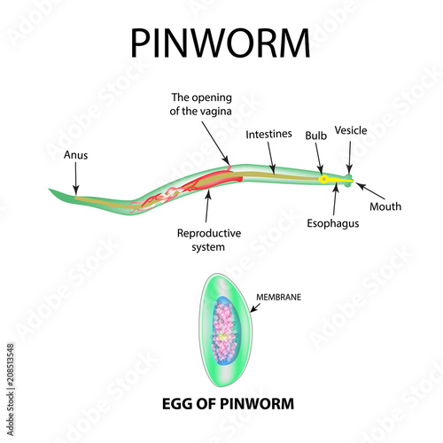 Pinworms structure of an adult. The structure of the pinworm egg. Set. Infographics. Vector illustration on isolated background. photo