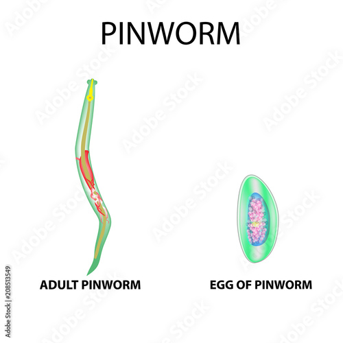 Pinworms structure of an adult. The structure of the pinworm egg. Set. Infographics. Vector illustration on isolated background. photo