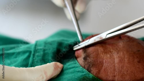 Doctor suturing cut wound at forehead. 
