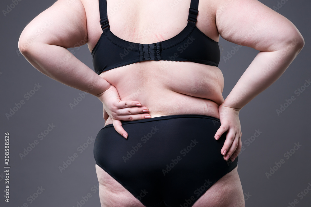 Back pain, fat woman with backache, overweight female body on gray background Back pain, fat woman with backache, overweight female body on gray background