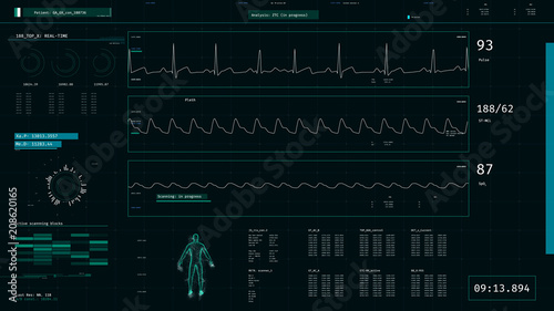 ICU monitor showing patient's condition, health, vital signs. Modern design. 3D illustration