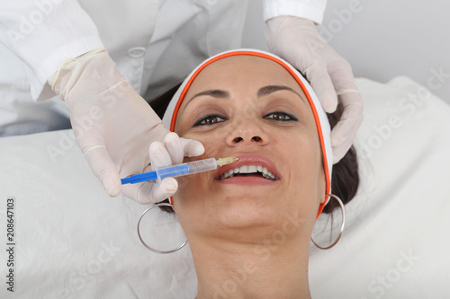 Lips Fillers Injection