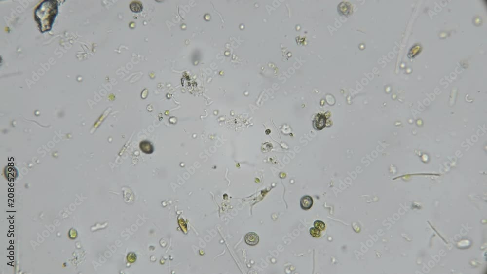 a drop of water from a dirty pond under a microscope, with a multitude of
