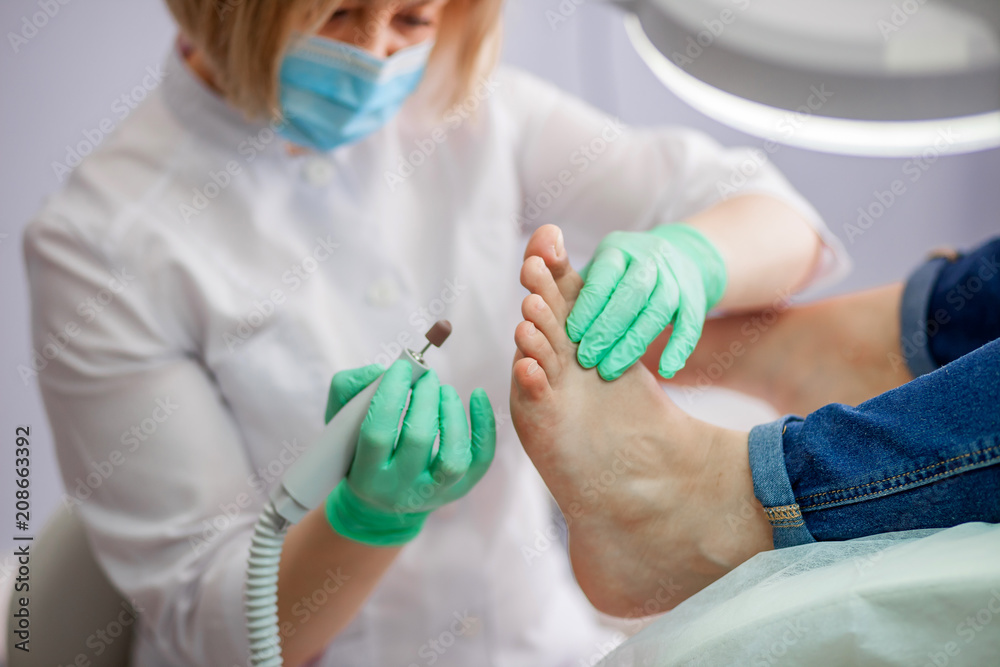 podiatrist treats foot using the milling machine. podiatrist treats foot using the milling machine.