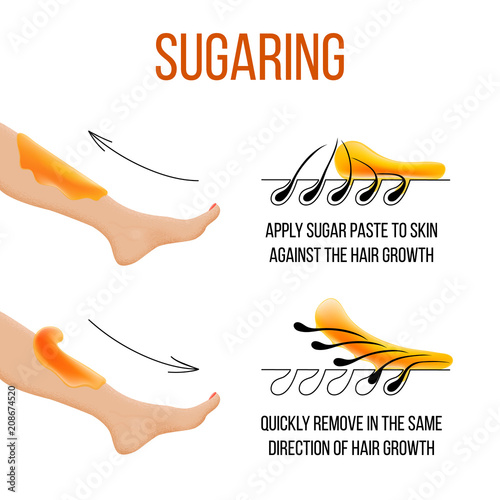 Depilation and sugaring. Hair removal. follicle. Woman leg with sugar or wax. Before and after. Process and steps of depilation. vector illustration