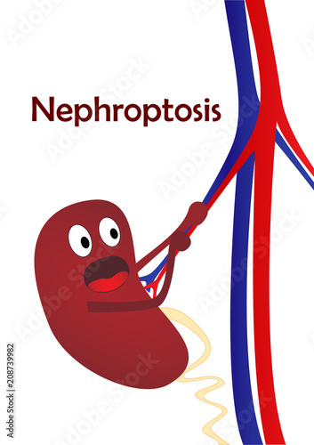 kidney disease nephroptosis, one cartoon kidney, isolated on white background, vertical vector illustration