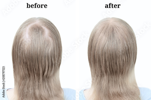 Women's blond hair after using cosmetic powder to thicken hair. Before and after photo