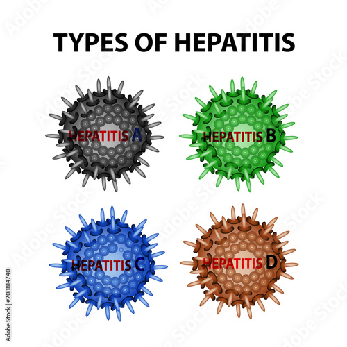 Types of Hepatitis. Viruses Hepatitis A, B, C, D. Infographics. Vector illustration on isolated background.