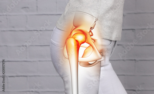 Woman suffering from hip joint pain photo