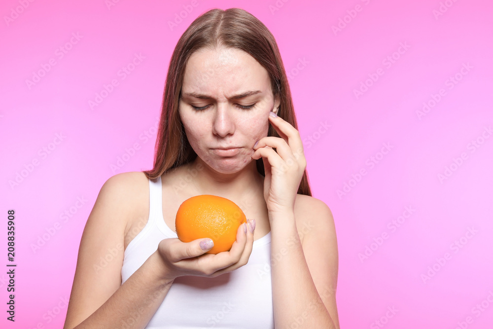 Young woman with acne problem holding orange on color background. Skin allergy Young woman with acne problem holding orange on color background. Skin allergy