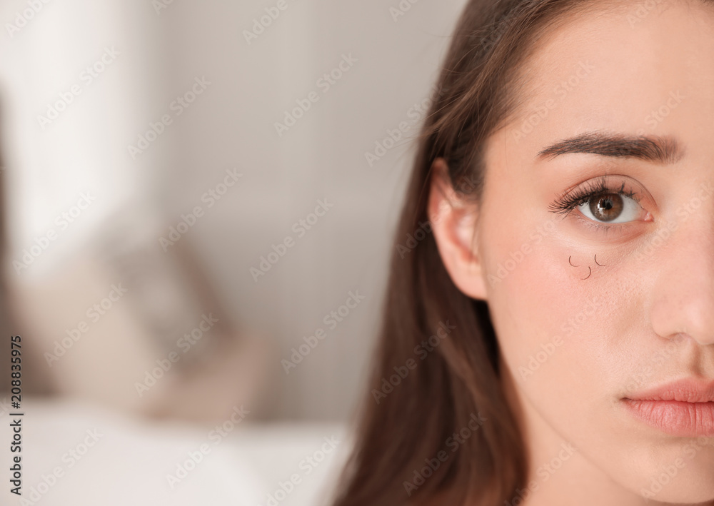Young woman with eyelash loss problem indoors Young woman with eyelash loss problem indoors