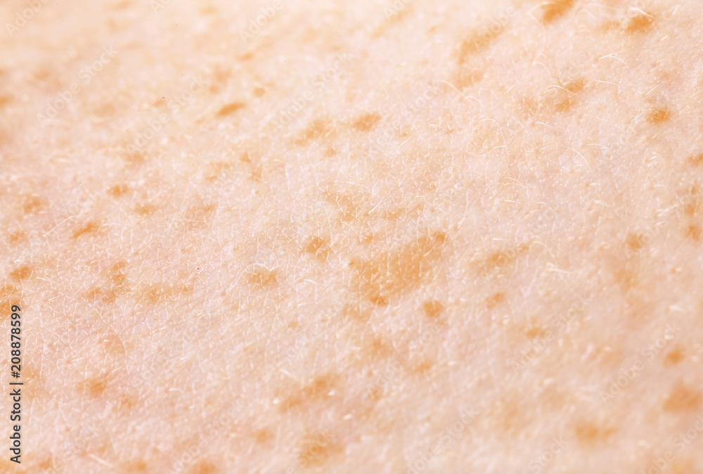 Texture of skin, closeup