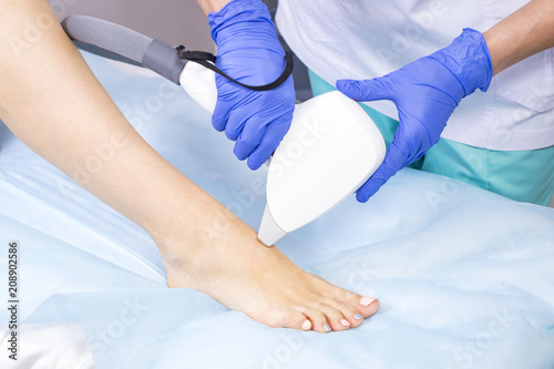 The process of laser depilation of female limbs in the beauty salon.  © lester120
