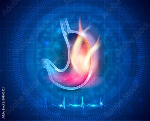 Stomach disorder abstract design, fire inside of the stomach