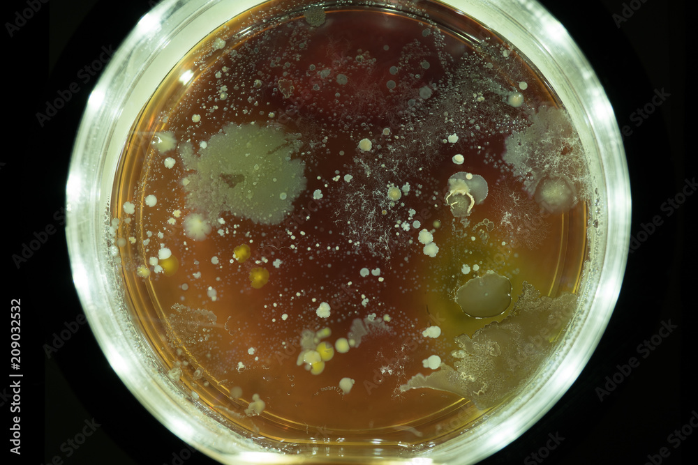 Growing Bacterial Colonies In Petri Dish Growing Bacterial Colonies In Petri Dish