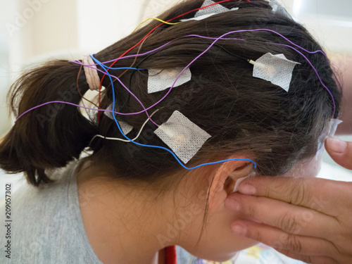 Girl with EEG electrodes attached to her head